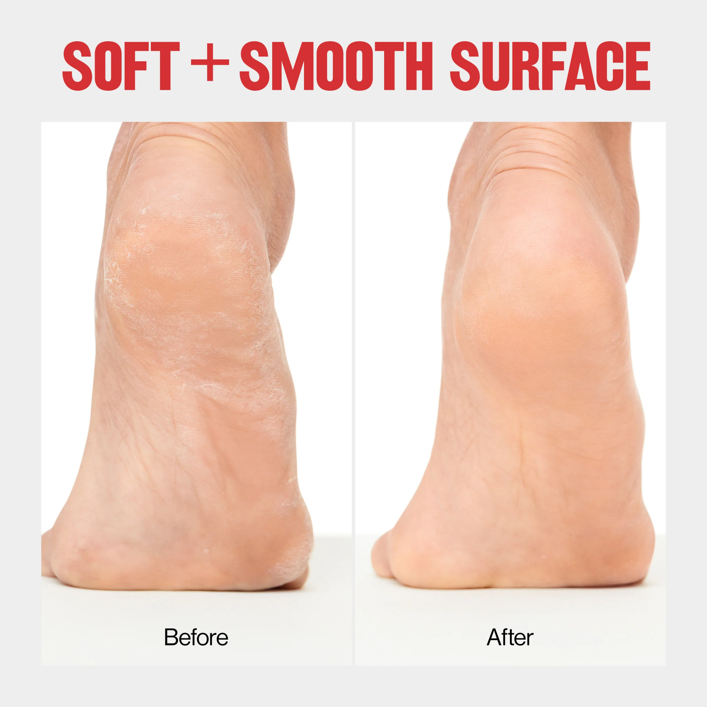 Wet/Dry Foot File - Pedicure Tool - Image 4